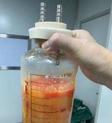 德宏水动力吸脂手术要做多久？
